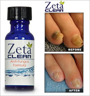 Zetaclear nail fungus treatment - Reviews 